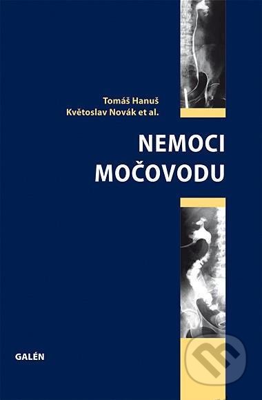 Nemoci močovodu
