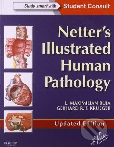 Netter's Illustrated Human Pathology