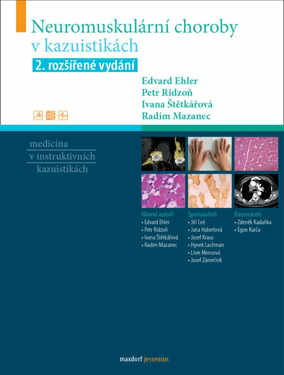 Neuromuskulární choroby v kazuistikách - Ivana Štětkářová, Edvard Ehler, Ridzoň Petr