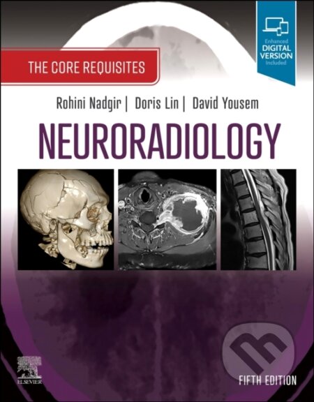 Neuroradiology (The Core Requisites)