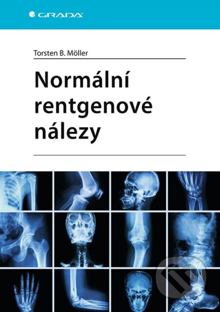 Normální rentgenové nálezy