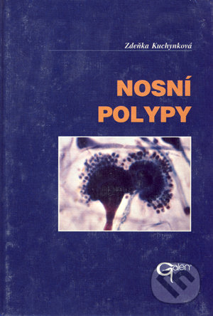 Nosní polypy