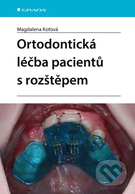 Ortodontická léčba pacientů s rozštěpem