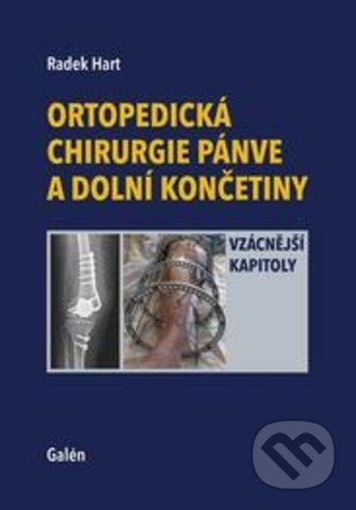 Ortopedická chirurgie pánve a dolní končetiny