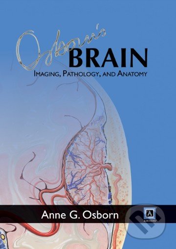 Osborn's Brain: Imaging, Pathology, and Anatomy