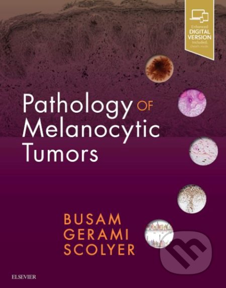 Pathology of Melanocytic Tumors