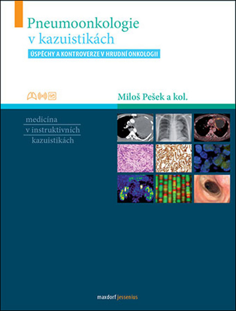 Pneumoonkologie v kazuistikách