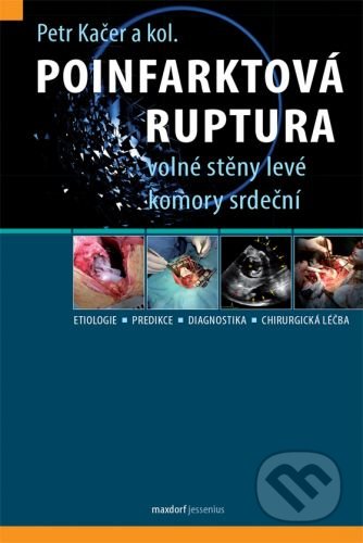 Poinfarktová ruptura