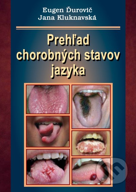 Prehľad chorobných stavov jazyka
