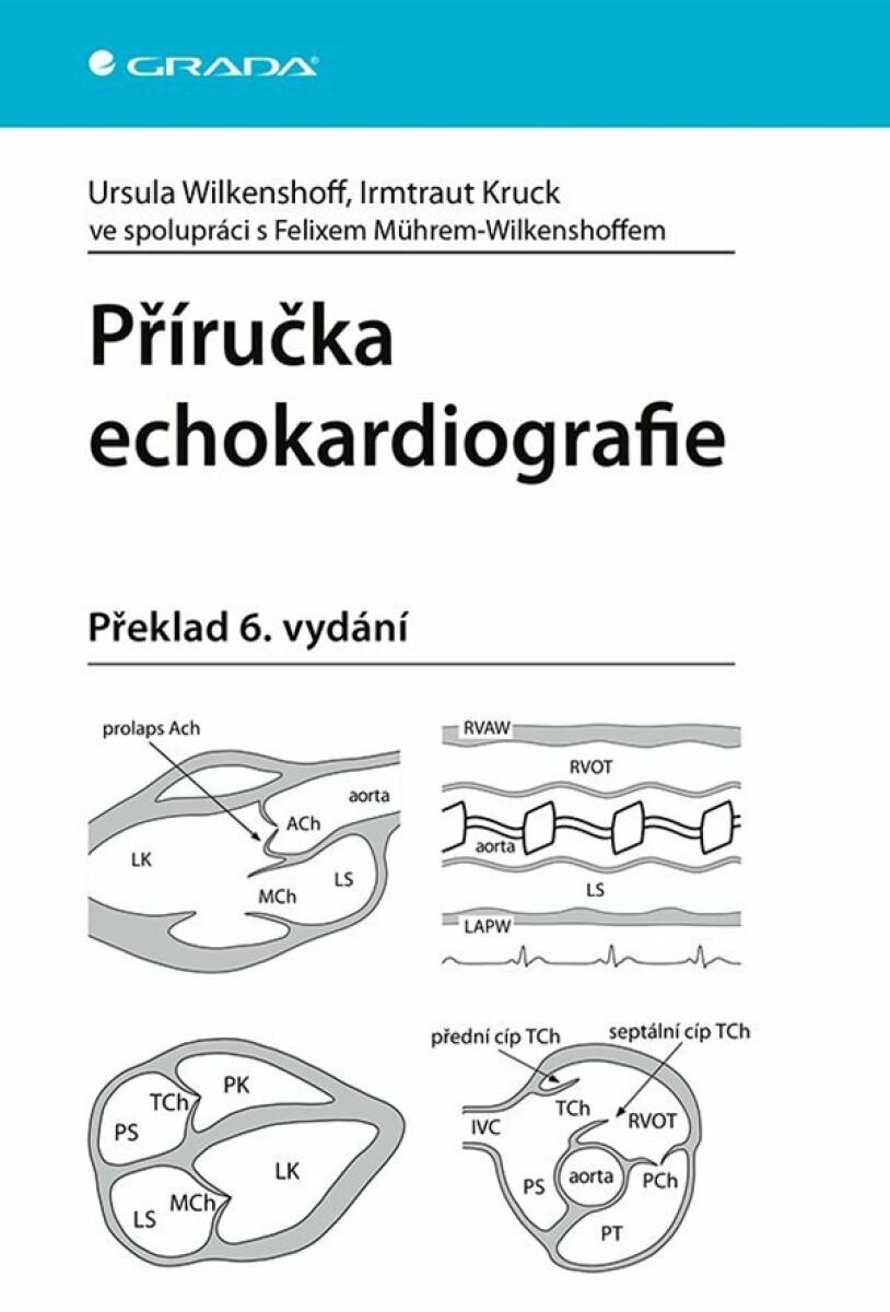 Příručka echokardiografie - Wilkenshoff Ursula, Kruck Irmtraut