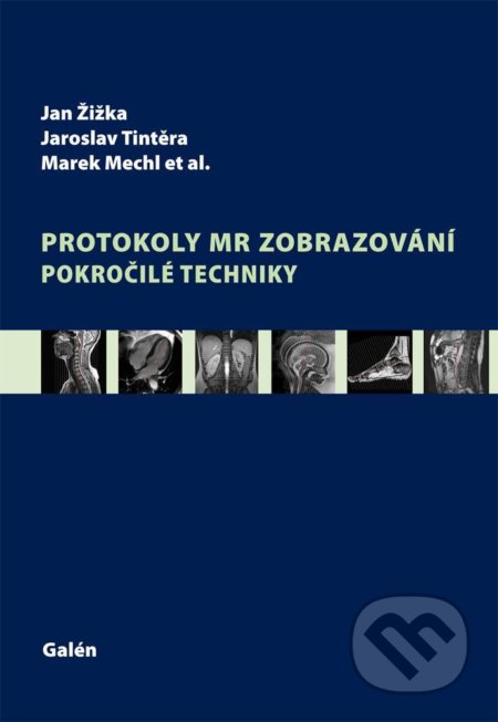 Protokoly MR zobrazování (Pokročilé techniky)