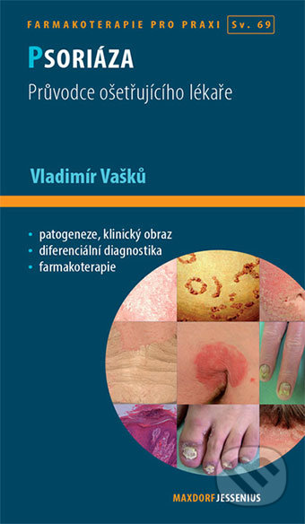 Psoriáza (Průvodce ošetrujíciho lékaře)