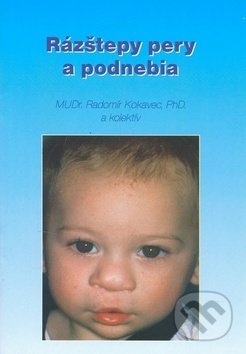 Rázštepy pery a podnebia