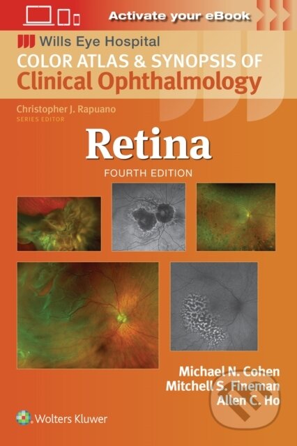 Retina