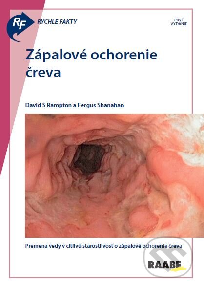 Rýchle fakty: Zápalové ochorenie čreva