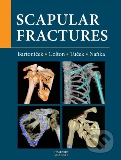 Scapular fractures