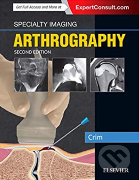 Specialty Imaging: Arthrography