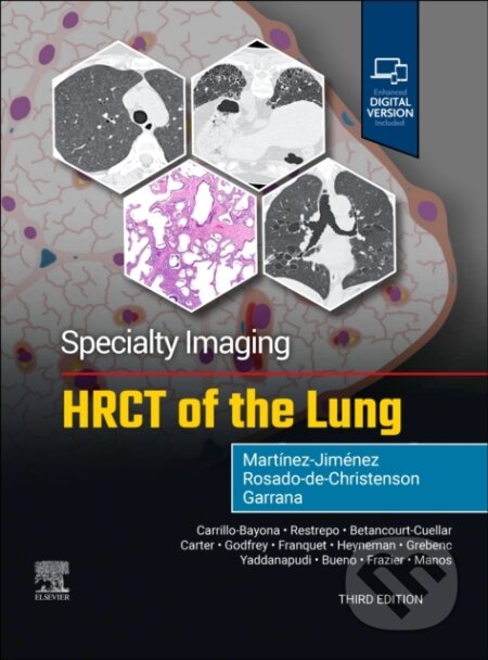 Specialty Imaging: HRCT of the Lung