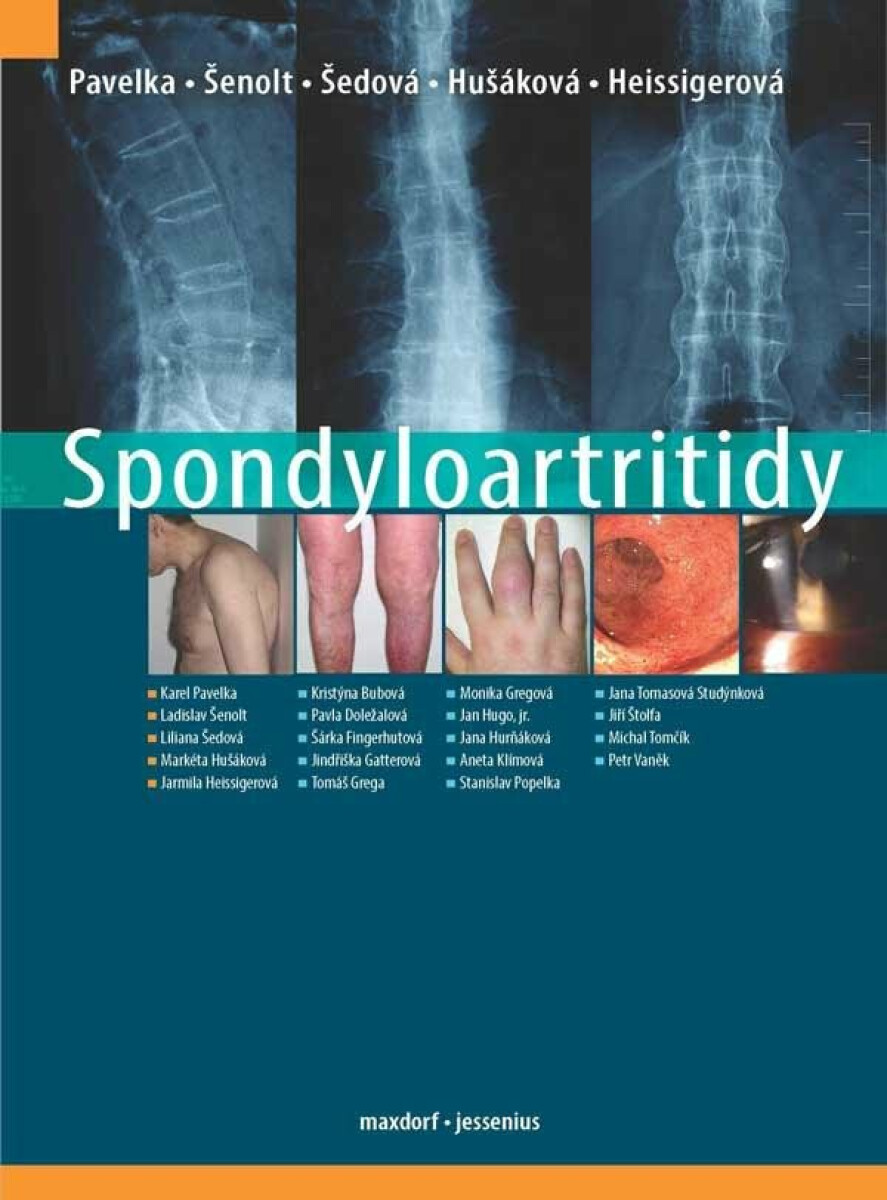 Spondyloartritidy - Karel Pavelka, kolektiv autorů, Jarmila Heissigerová, Markéta Hušáková, Ladislav Šenolt, Liliana Šedová