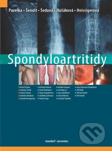 Spondyloartritidy