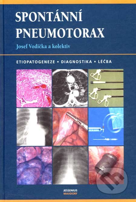 Spontánní pneumotorax (Etiopatogeneze - Diagnostika