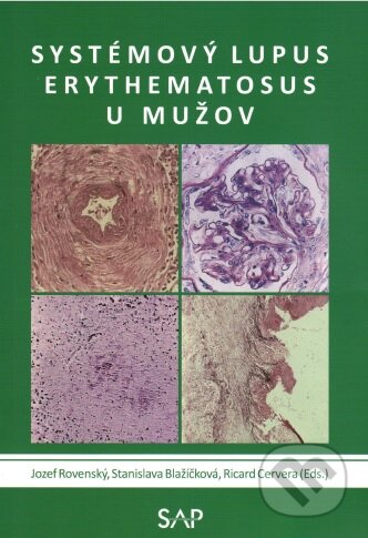 Systemovy lupus erythematosus u muzov