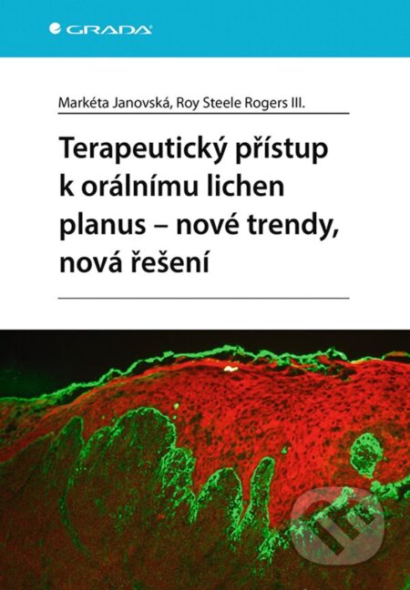 Terapeutický přístup k orálnímu lichen planus