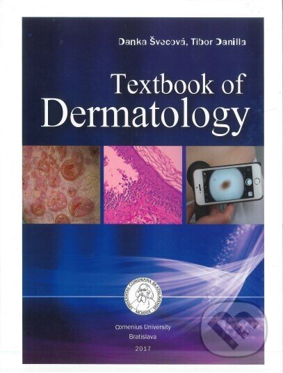 Textbook of Dermatology