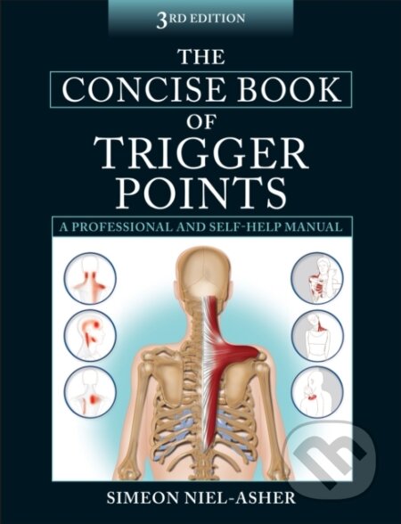 The Concise Book of Trigger Points