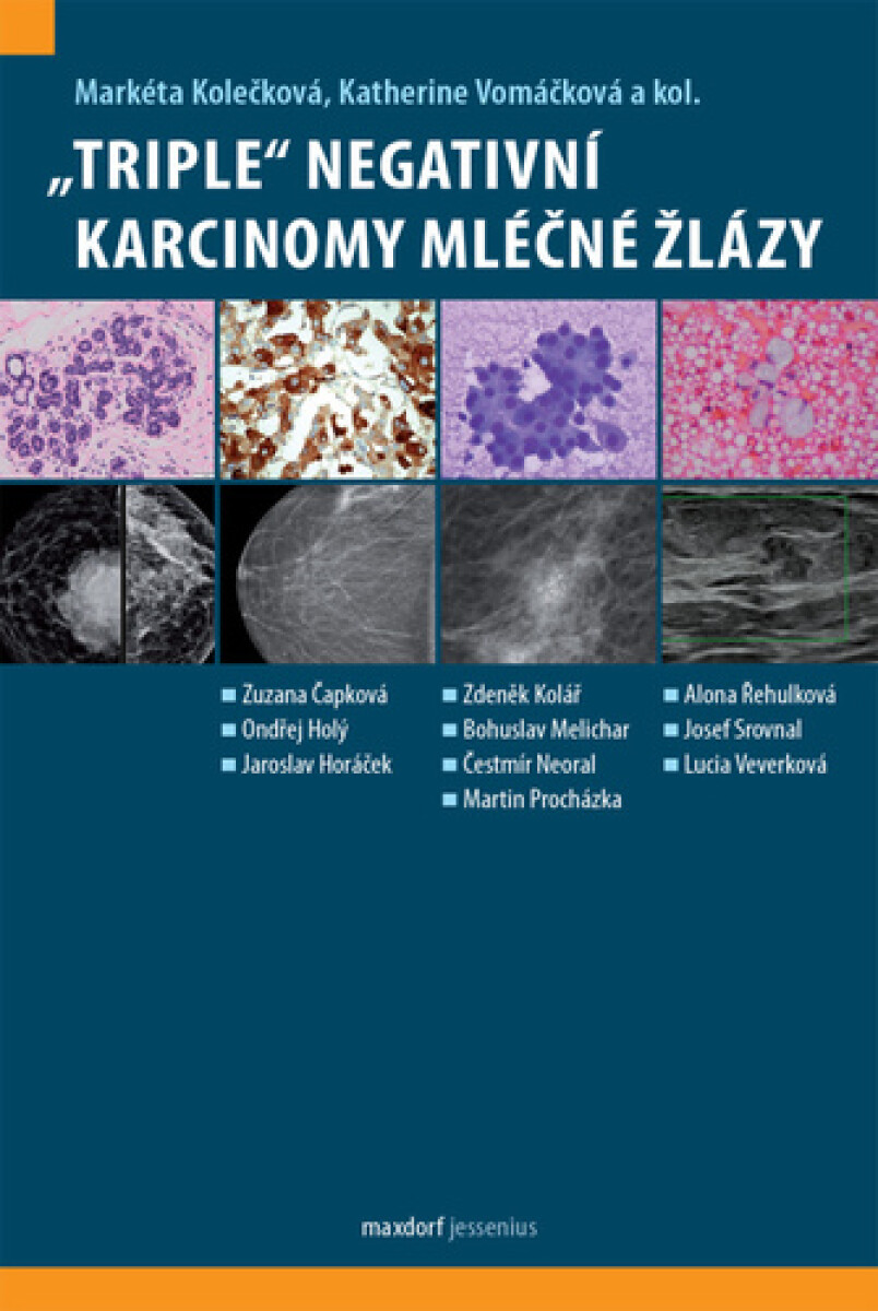 "Triple" negativní karcinomy mléčné žlázy - Markéta Kolečková