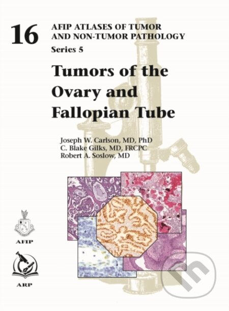 Tumors of the Ovary and Fallopian Tube