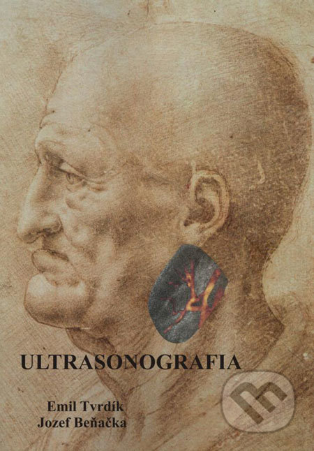 Ultrasonografia