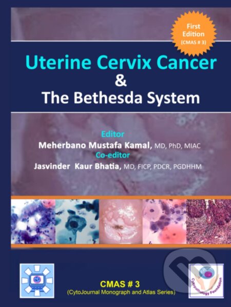 Uterine Cervix Cancer The Bethesda System