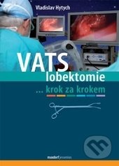 VATS lobektomie (...krok za krokem)