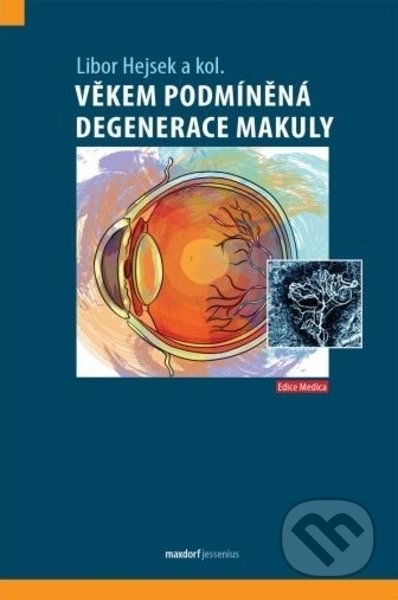 Věkem podmíněná degenerace makuly