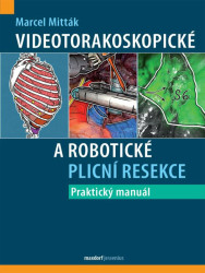 Videotorakoskopické a robotické plicní resekce - Mitták Marcel