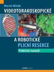 Videotorakoskopické a robotické plicní resekce