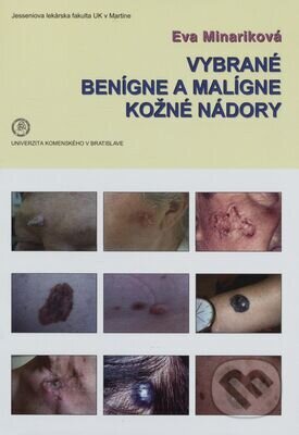 Vybrané benígne a malígne kožné nádory