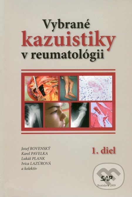 Vybrané kazuistiky v reumatológii (1+2 diel)