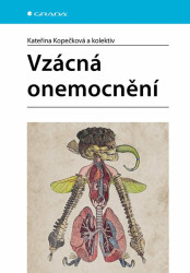 Vzácná onemocnění - Kateřina Kopečková
