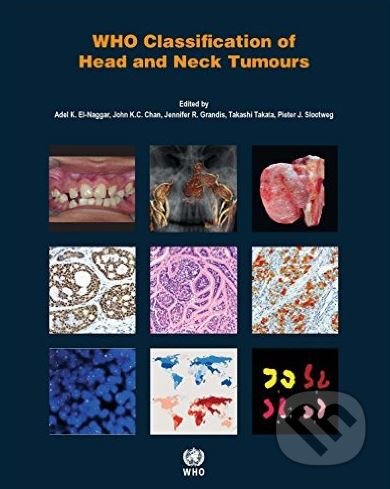 WHO Classification of Head and Neck Tumours