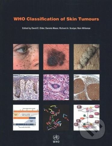 Who Classification of Skin Tumours