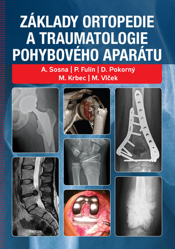 Základy ortopedie a traumatologie pohybového aparátu - Antonín Sosna, Martin Krbec, P. Fulín
