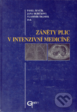 Záněty plic v intenzivní medicíně