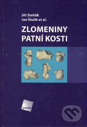 Zlomeniny patní kosti