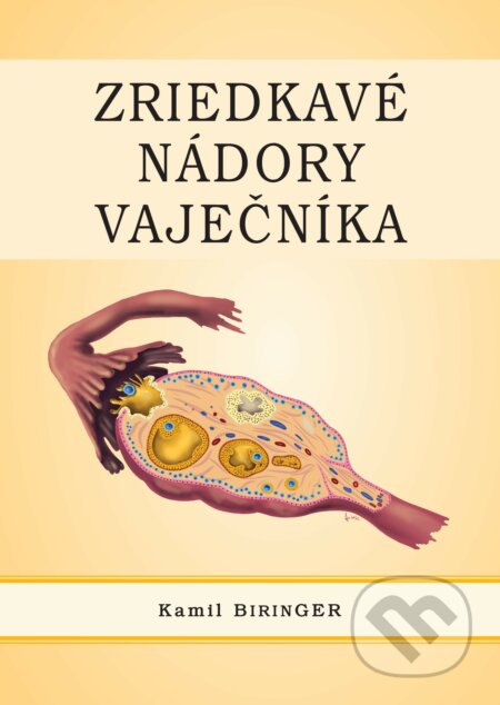Zriedkavé nádory vaječníka