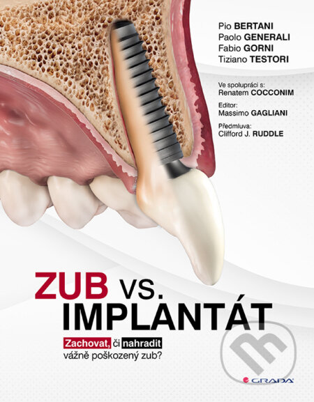 Zub vs. implantát